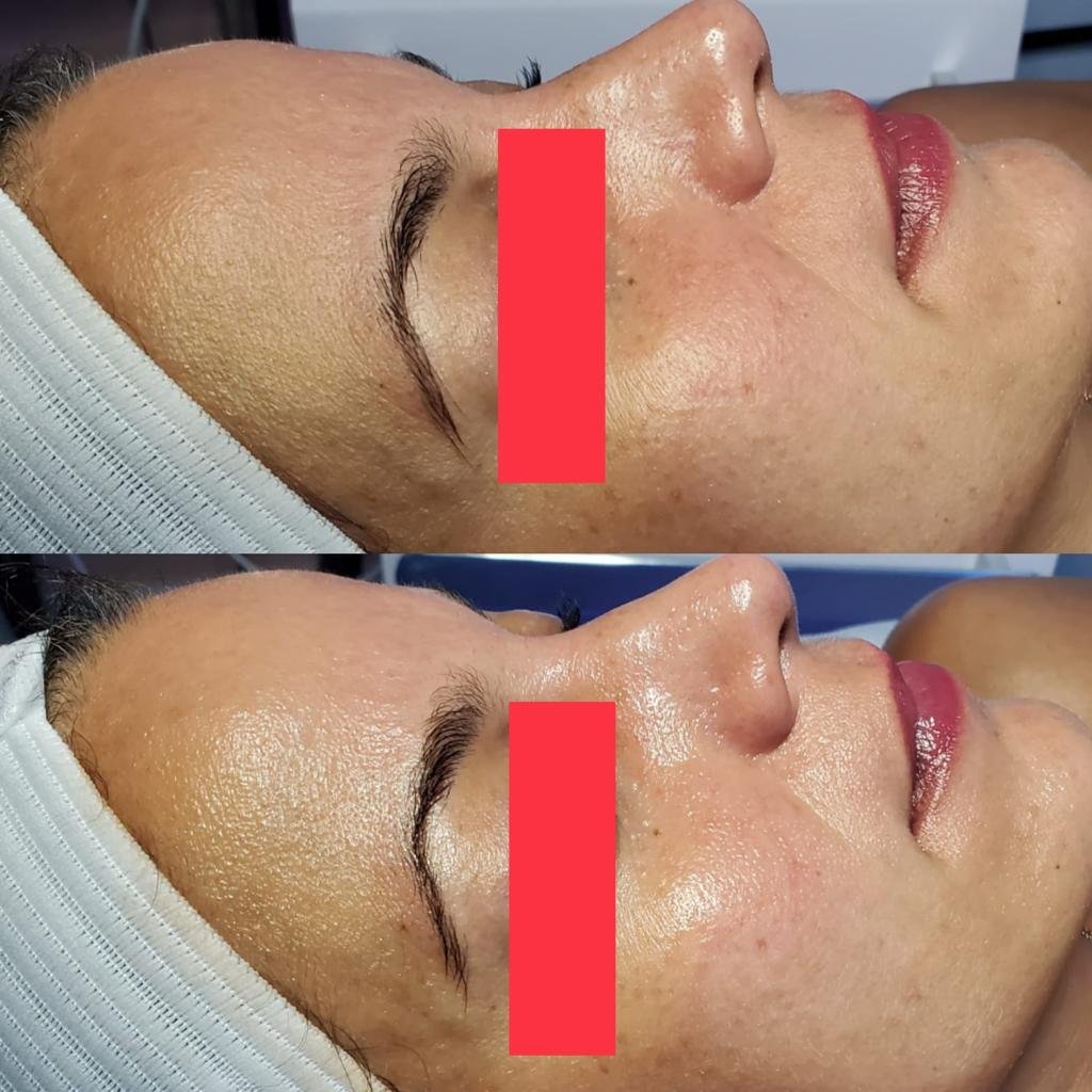 BEFORE AFTER 01
