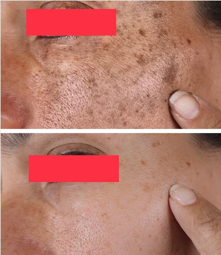 BEFORE AFTER 06